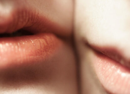 Manage Cold Sores with These Foods and Vitamins