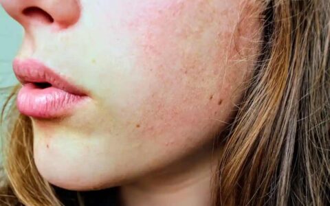 Food that Improve Skin Complexion